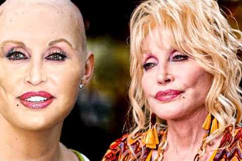 Dolly Parton Reveals Her Real Hair (Why She Wears Wigs)